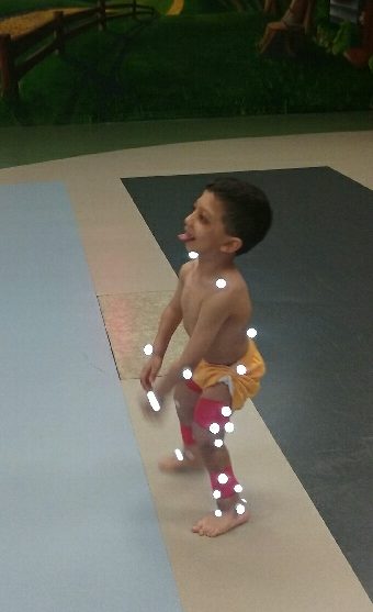 Gait Lab, AI Duppont Hospital, Delaware