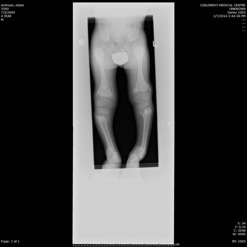 Clinical photo of patient