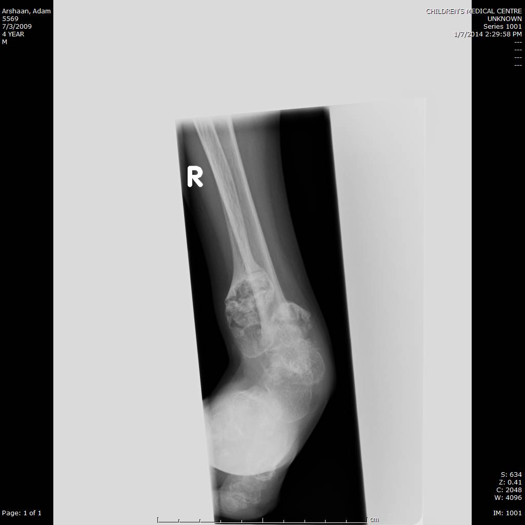 Clinical photo of patient