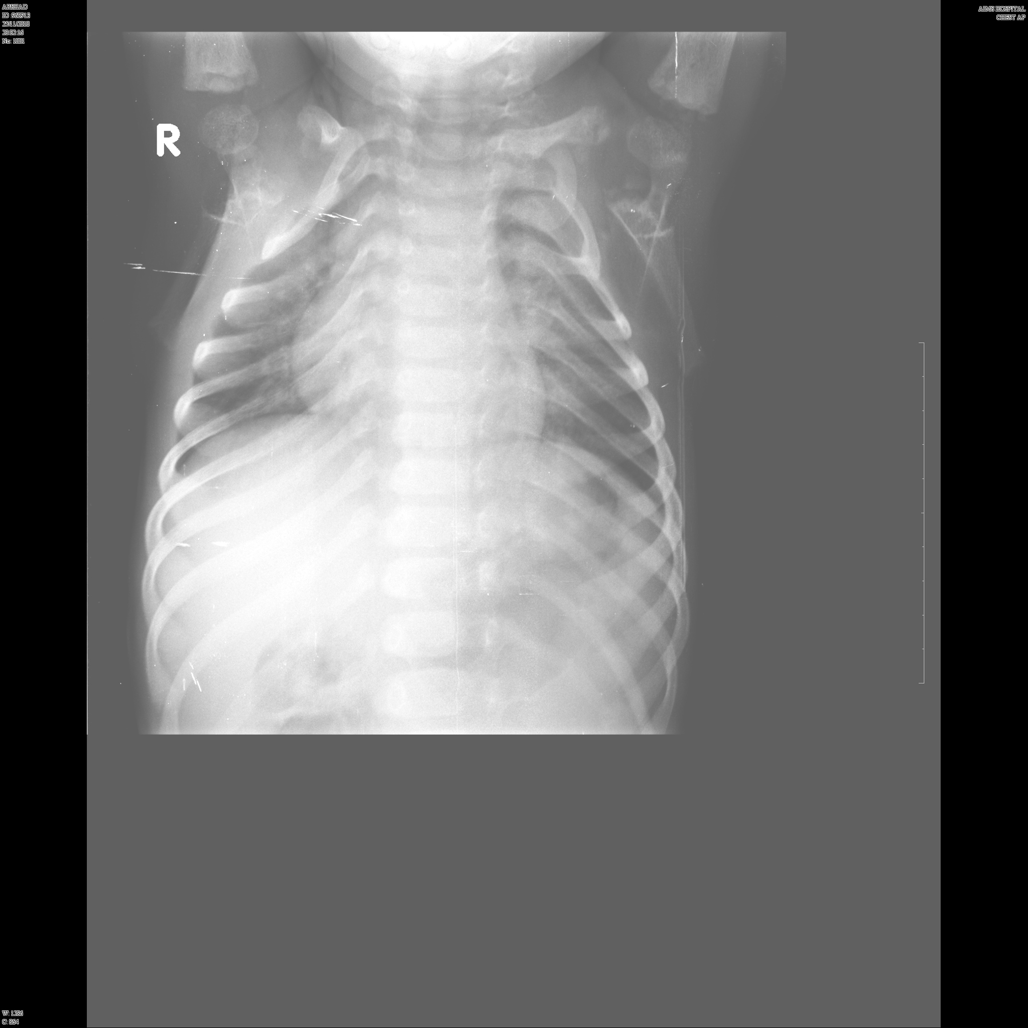 Spine X-ray showing skeletal abnormalities